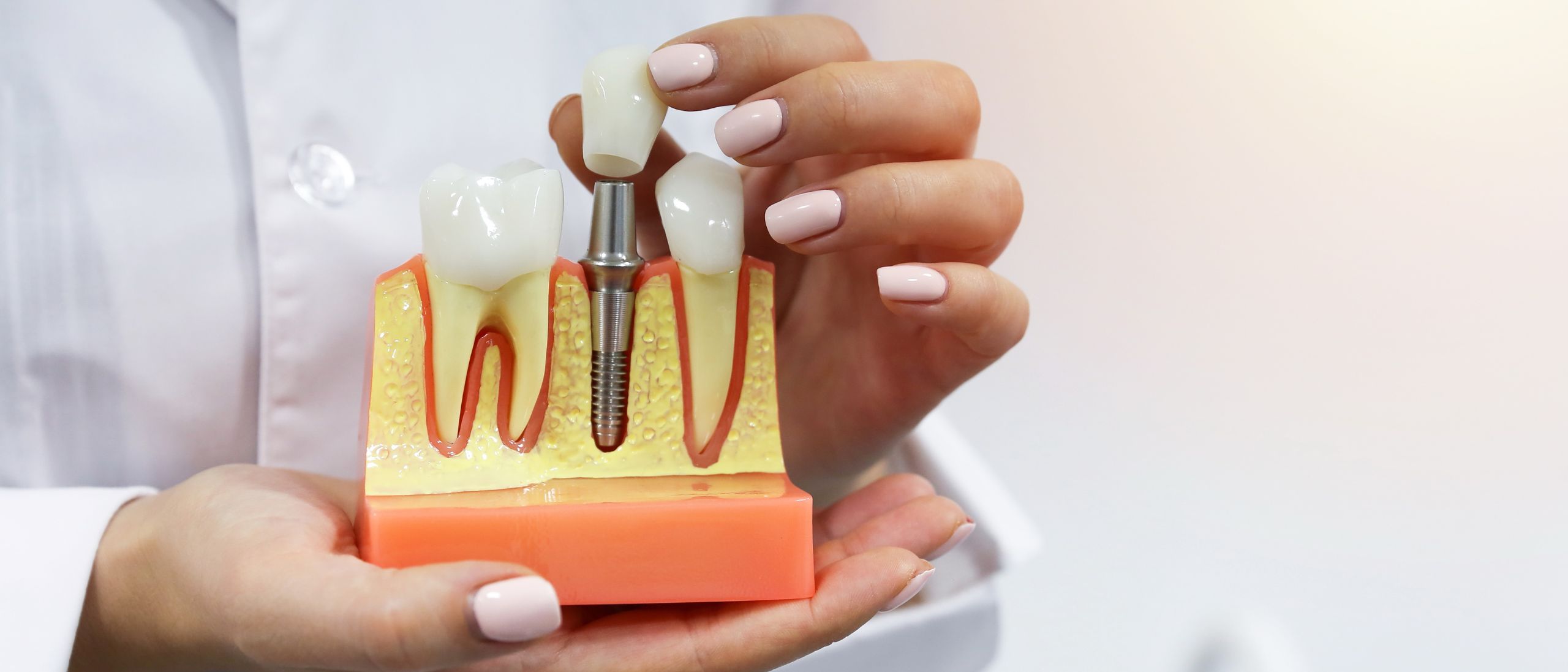 Dental_Club_implantologia_estetica